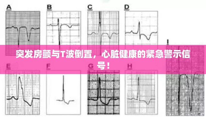 突发房颤与T波倒置，心脏健康的紧急警示信号！