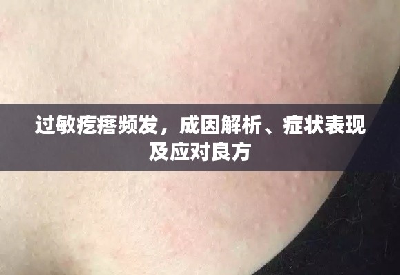过敏疙瘩频发，成因解析、症状表现及应对良方